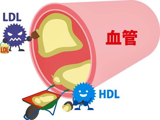LDLコレステロールとHDLコレステロールのイメージ